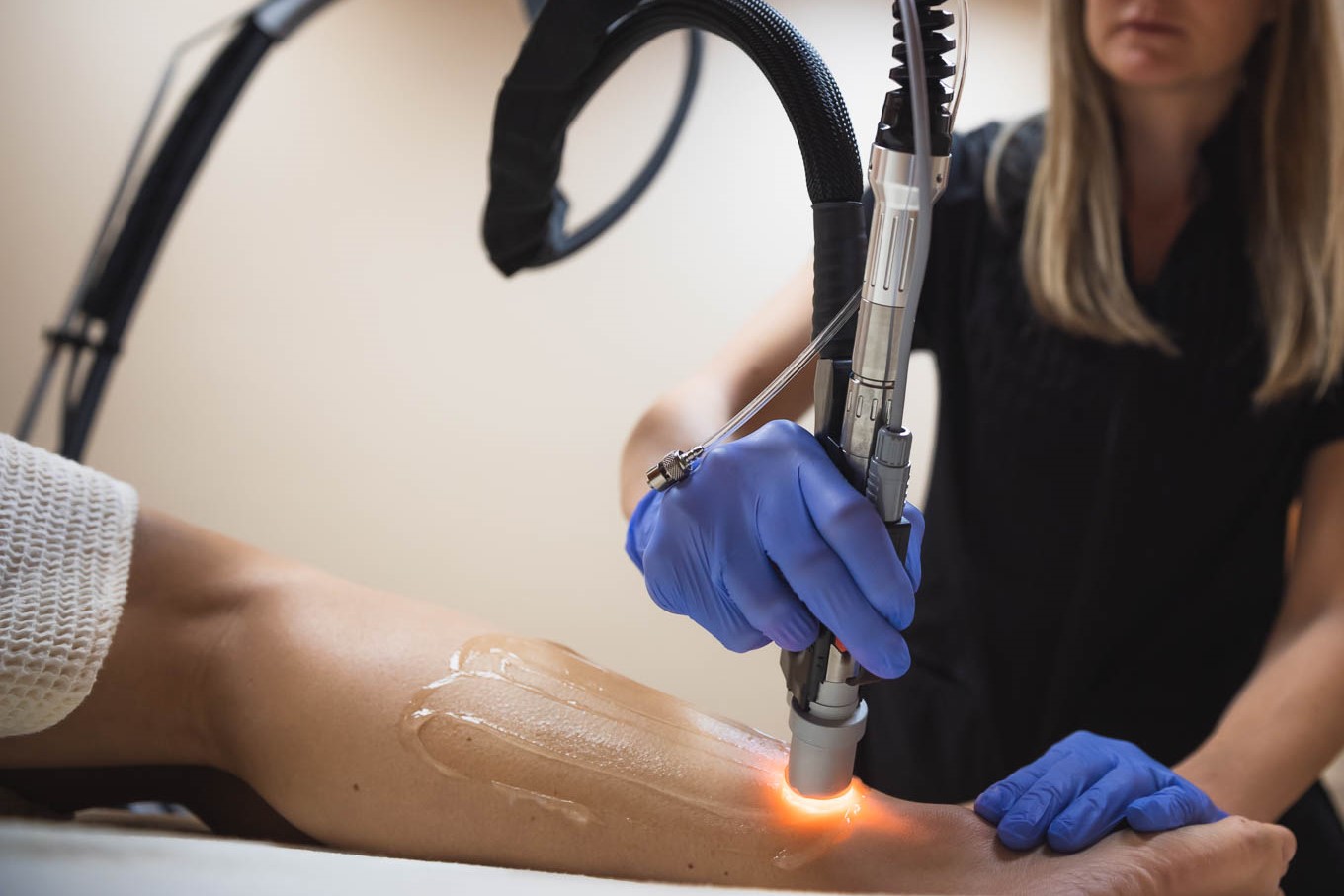 Laser Hair Removal in West Bloomfield Dr. Susan Seman